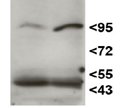 HEN1 | HUA ENHANCER 1 in the group Antibodies Plant/Algal  / DNA/RNA/Cell Cycle / microRNA at Agrisera AB (Antibodies for research) (AS15 3095)